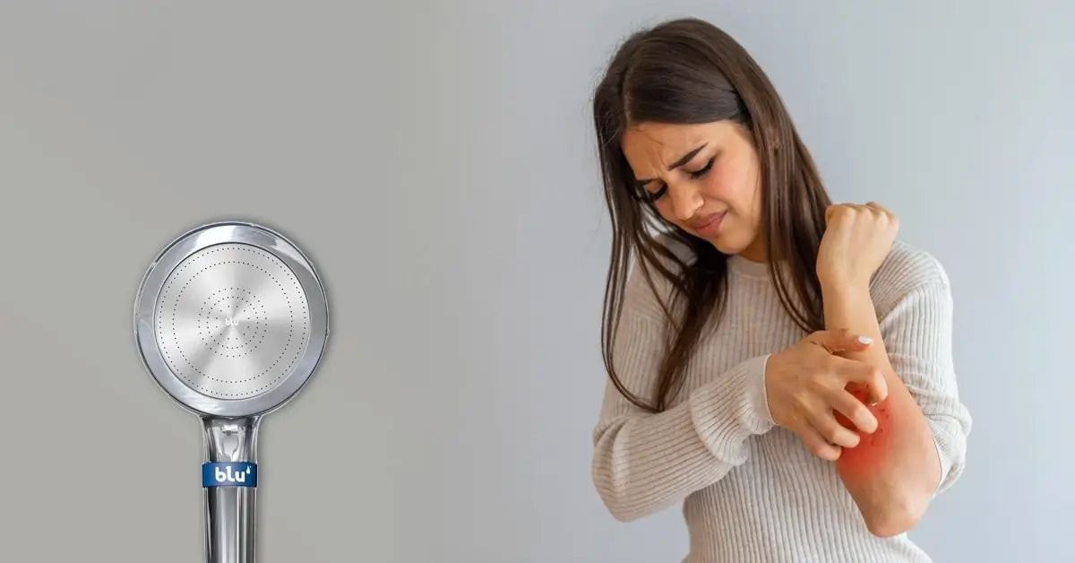 Common Causes Of Body Itching and Treatments That Help