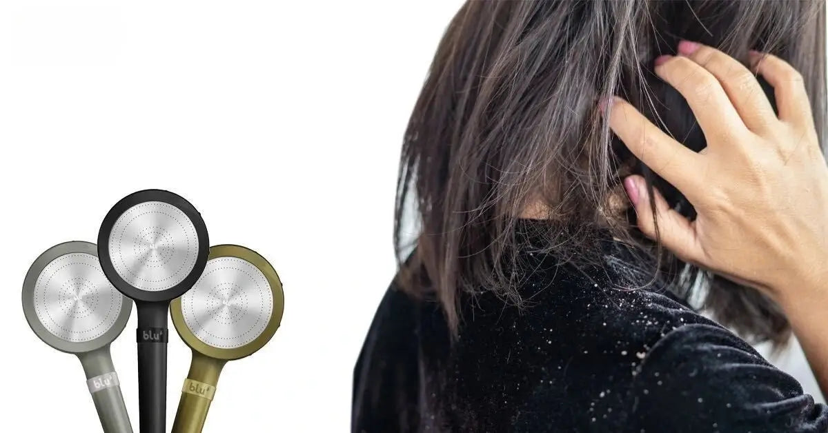 Does Dandruff Cause Hair Loss?